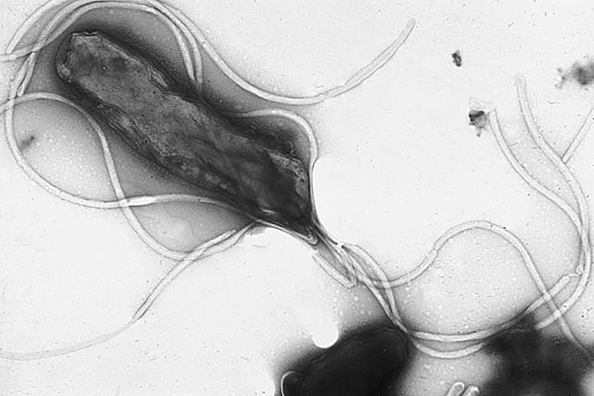 Helicobacter pylori. Credit: Penn state on Flickr. CC BY-NC-ND 2.0