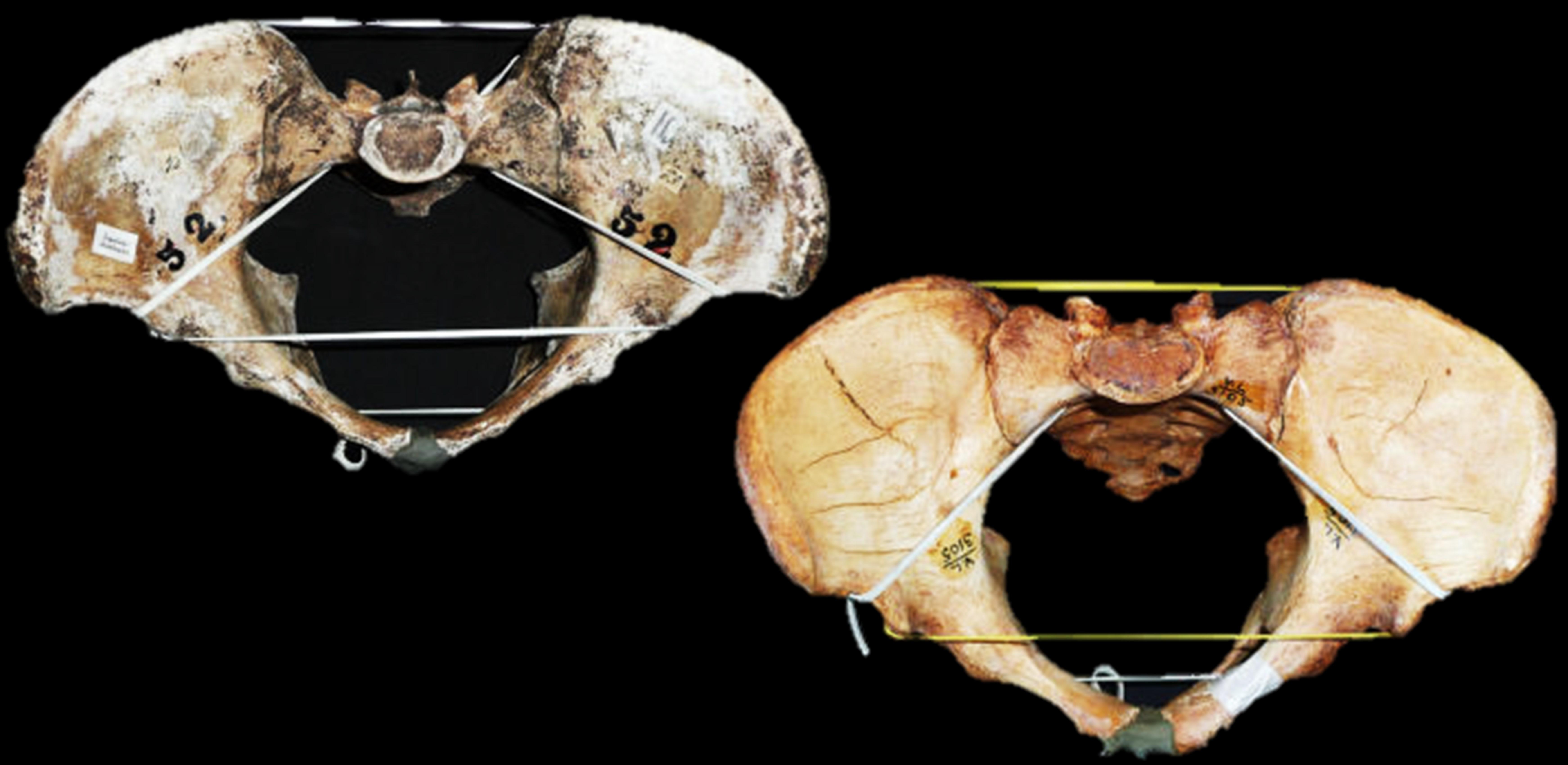 Two different female pelvises from the paper.