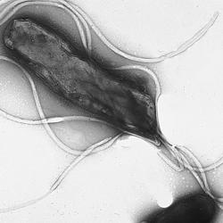 Helicobacter pylori. Credit: Penn state on Flickr. CC BY-NC-ND 2.0